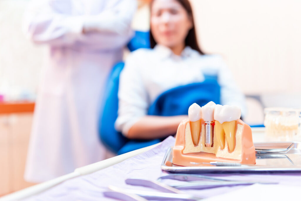 Dentist with tooth implant false teeth. Dentistry and healthcare